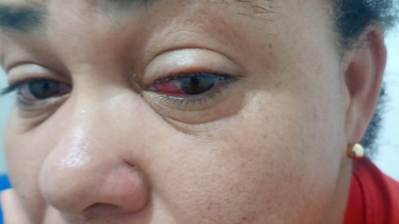 Agressão em Morro do Chapéu: Uma mulher é vítima de violência praticada por Policial Militar